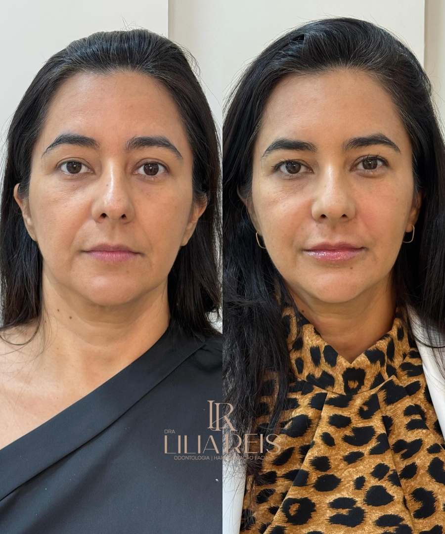 Antes e depois 5